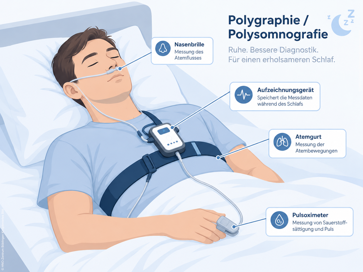 Grafische Darstellung einer nächtlichen Polygraphiemessung mit Atemsensor, Pulsoximeter und Messgerät